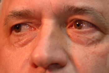 Foto: Frank Mulleman (SocFo)